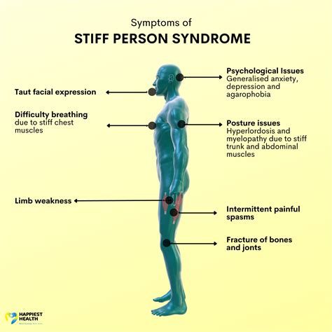 stiff person syndrome timeline